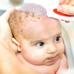 Cara Menghilangkan Kerak Pada Kulit Kepala Bayi